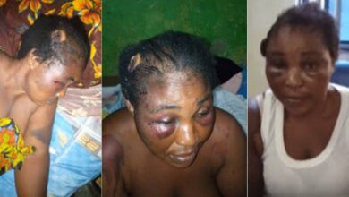 Lady Brutalised By Her Brother-In-Law Who Is Lawmaker - Video