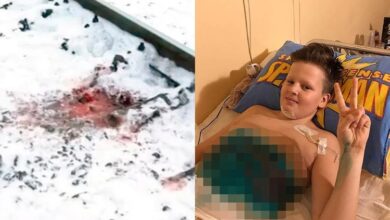 11-year-old boy Legs Sliced By Moving Train After Friends Pressured Him To Train Surfing - Watch