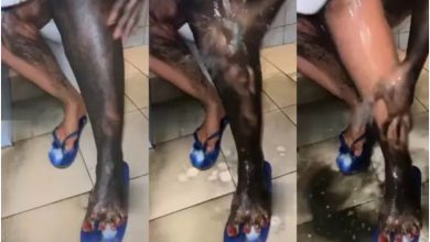 Video Of New Procedures Ladies Use To Bleach Their Skin Trends Online